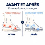Schéma avant/après Youva Cloud, répartition de la pression sous le pied pour plus de confort